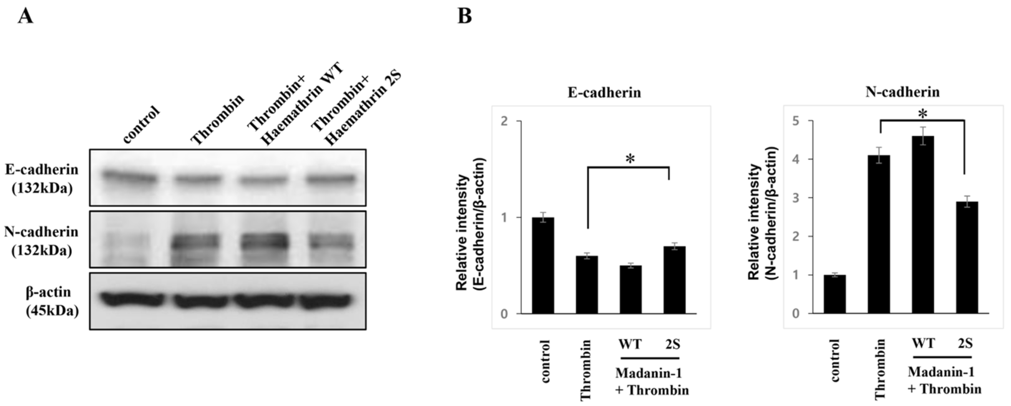 Ijms 25 11822 g004 Ijms 25 11822 g004