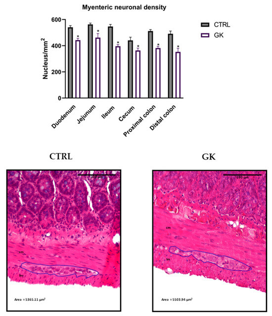 paul chek glutathione ALDH1L2 regulates reactive oxygen species and acinar-to-ductal metaplasia in the pancreas Stream Ep.106 - Paul Chek: