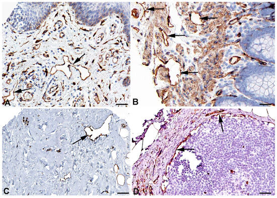 Molecules That Have Rarely Been Studied in Lymphatic Endothelial Cells