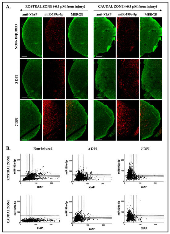 Identification of a New Role of miR-199a-5p as Factor Implied in