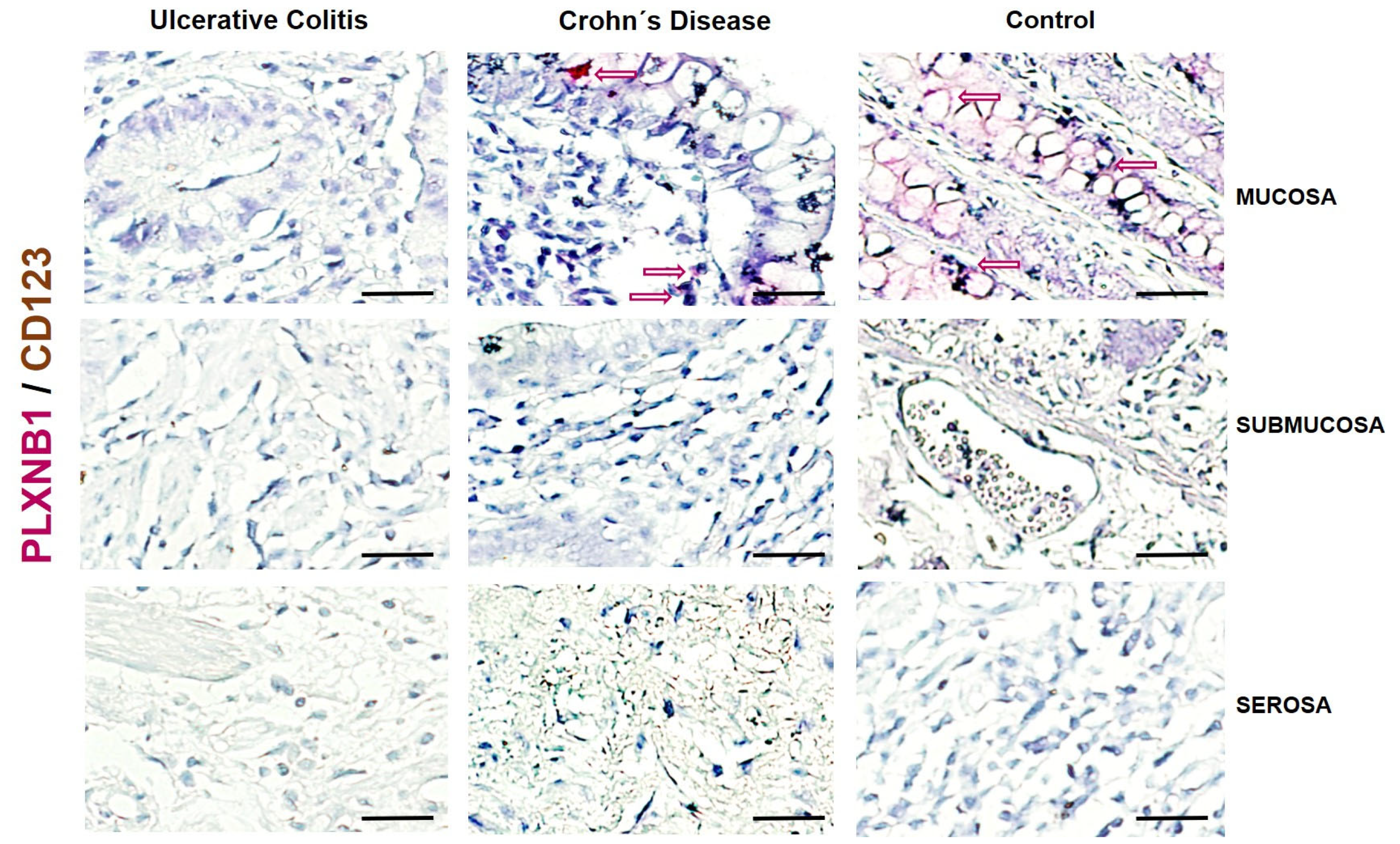 Ijms 25 12442 g004 Ijms 25 12442 g004