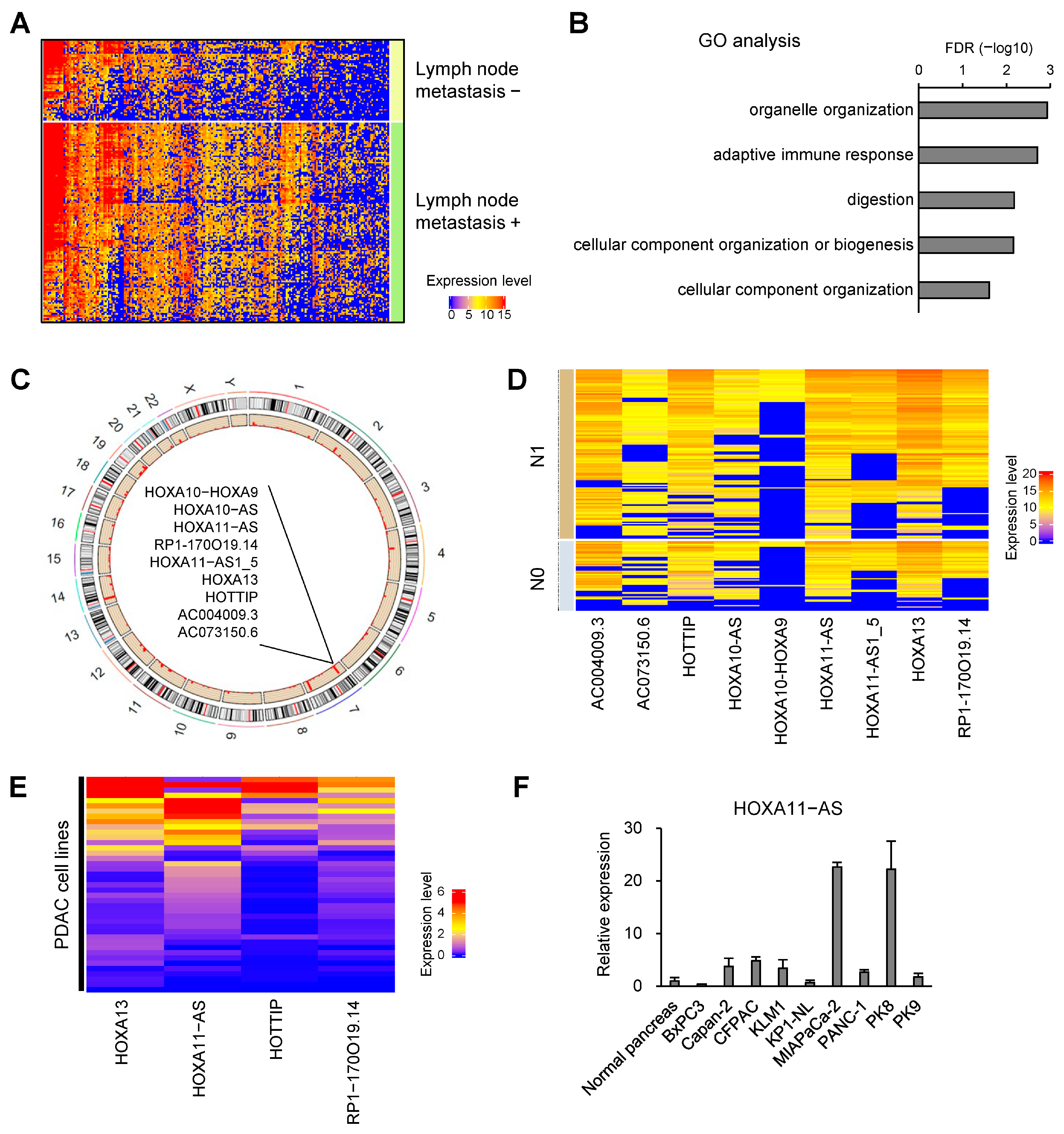 HOXA11-As Promotes Lymph Node Metastasis Through Regulation HOXA11-As Promotes Lymph Node Metastasis Through Regulation