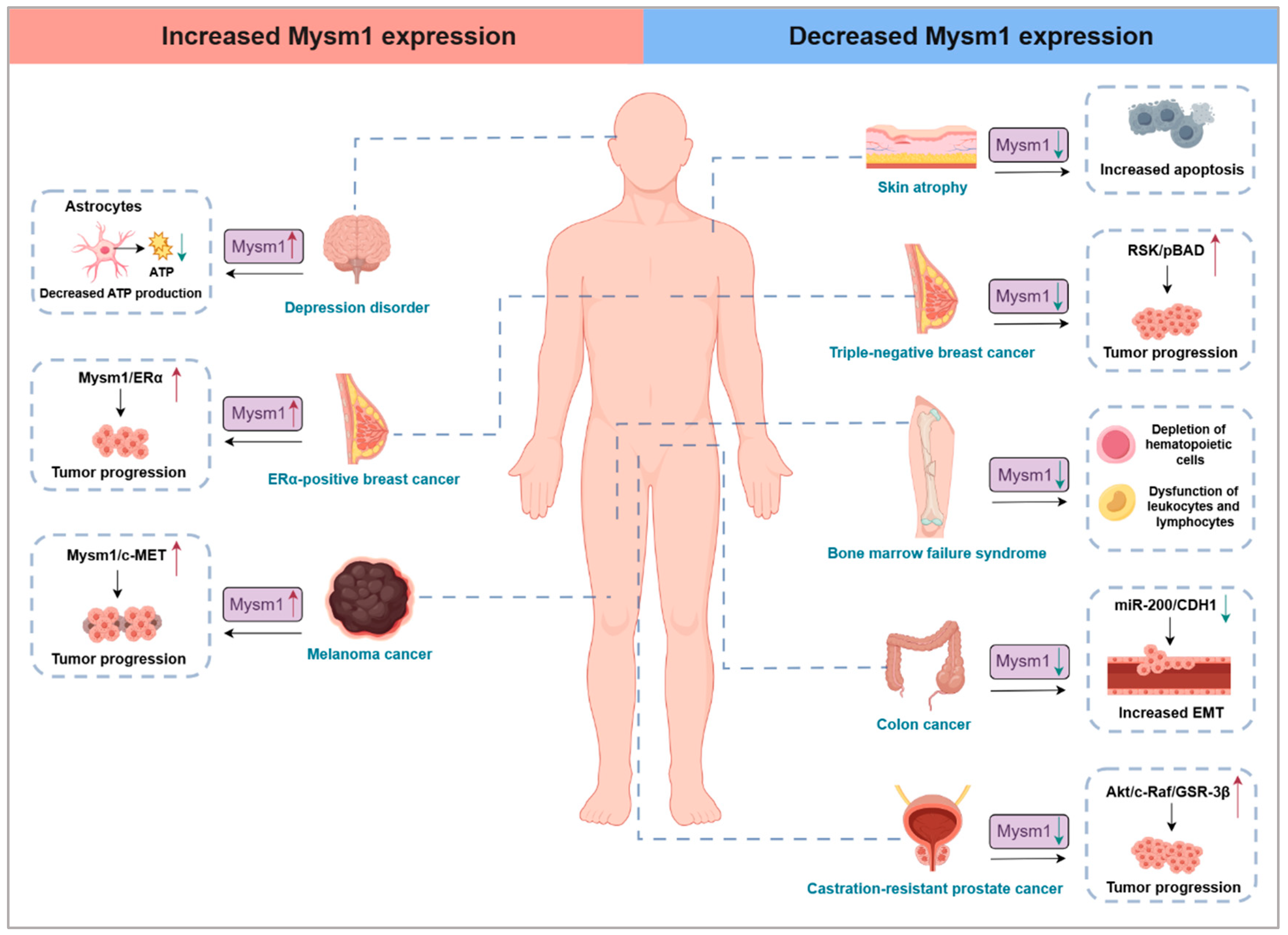 Deubiquitinase MYSM1: An Important Tissue Development and