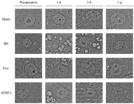 Exosomes Derived from Adipose Mesenhymal Stem Cells Exosomes Derived from Adipose Mesenhymal Stem Cells