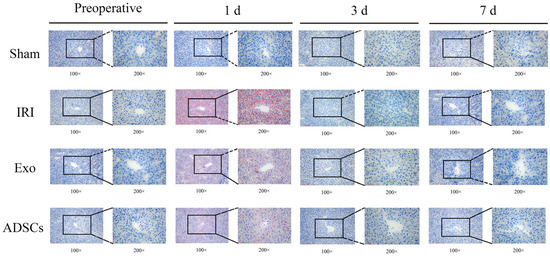 Exosomes Derived from Adipose Mesenhymal Stem Cells