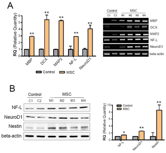 Mitigation of Atherosclerotic Vascular Damage and Cognitive