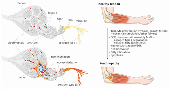 Impact of the COL1A1 Gene Polymorphisms on Pain Perception in Tennis ...
