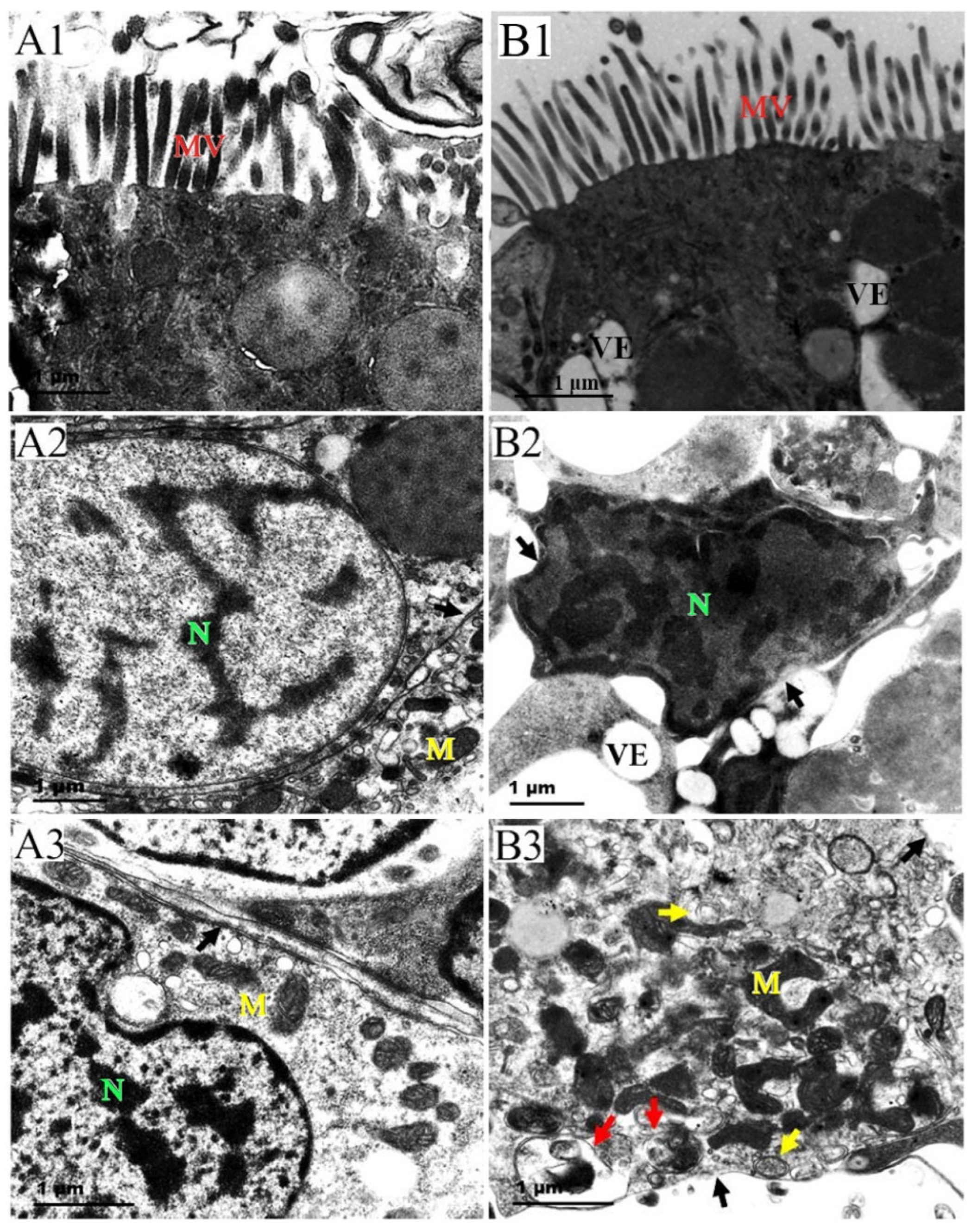 Cadmium-Induced Oxidative Damage and the Expression and