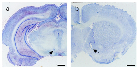 Amphetamine Injection into the Nucleus Accumbens and