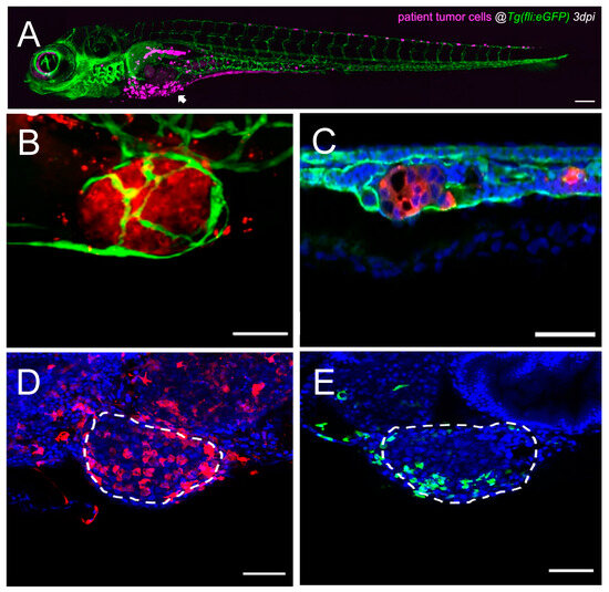 Small Fish, Big Answers: Zebrafish and the Molecular Drivers of Metastasis