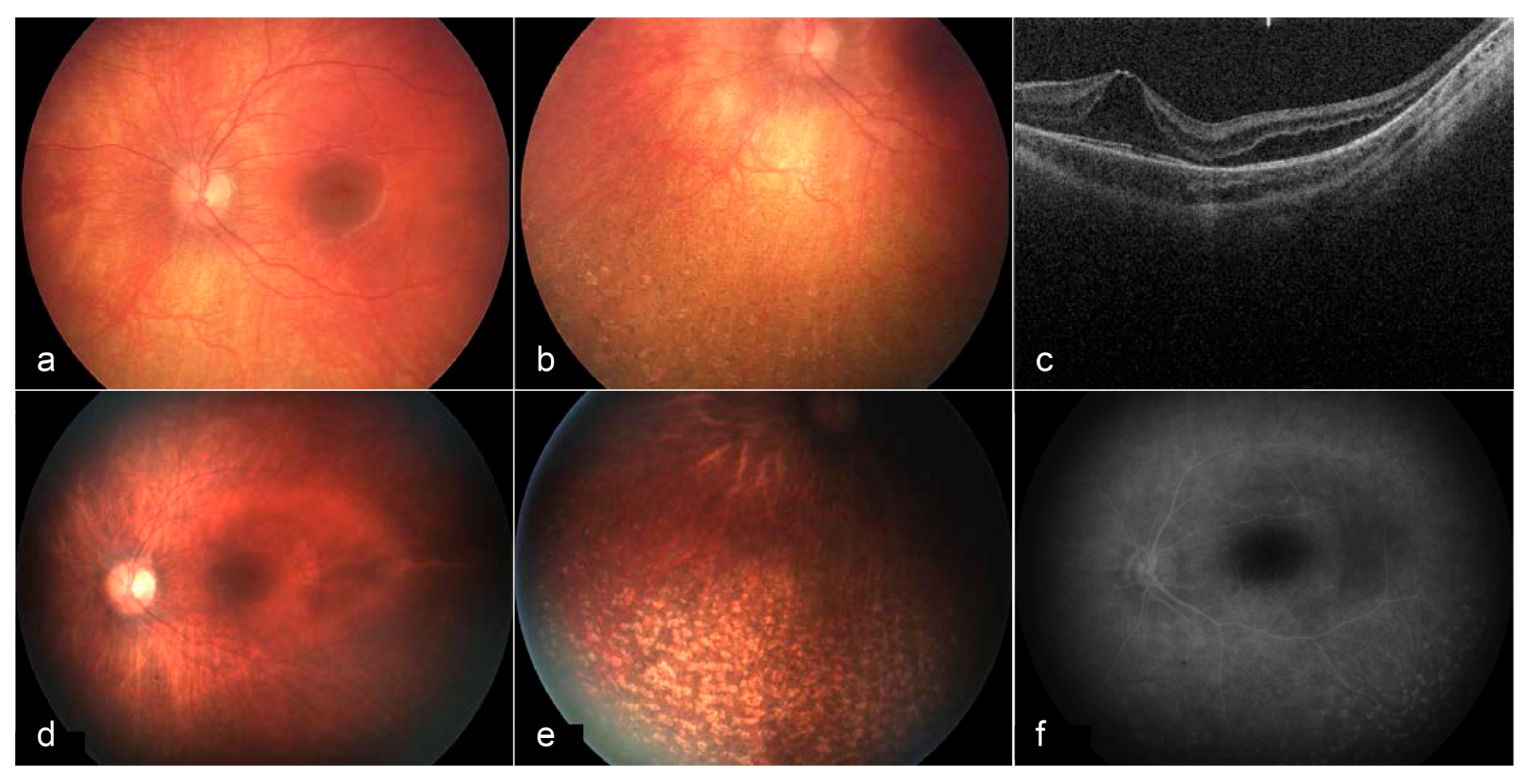 Ijms 26 00957 g004 Ijms 26 00957 g004