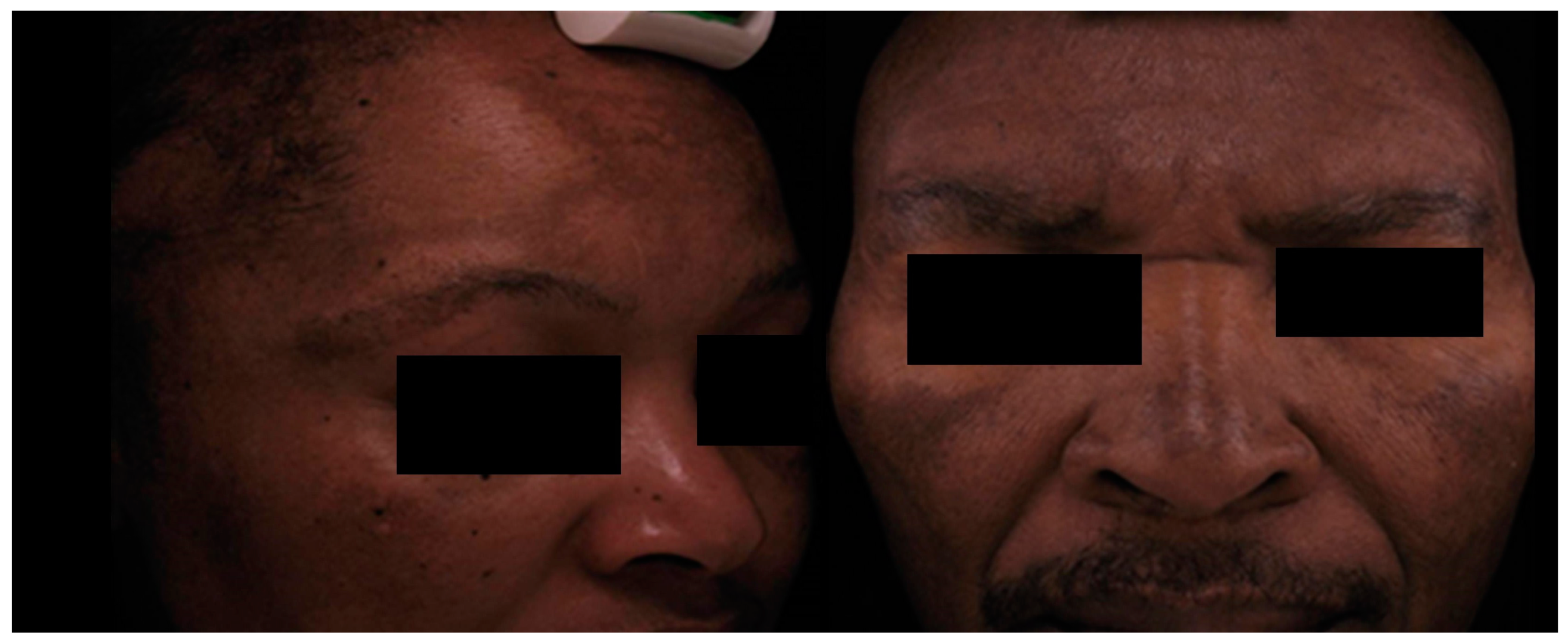 Ijms 26 01158 g001 Ijms 26 01158 g001