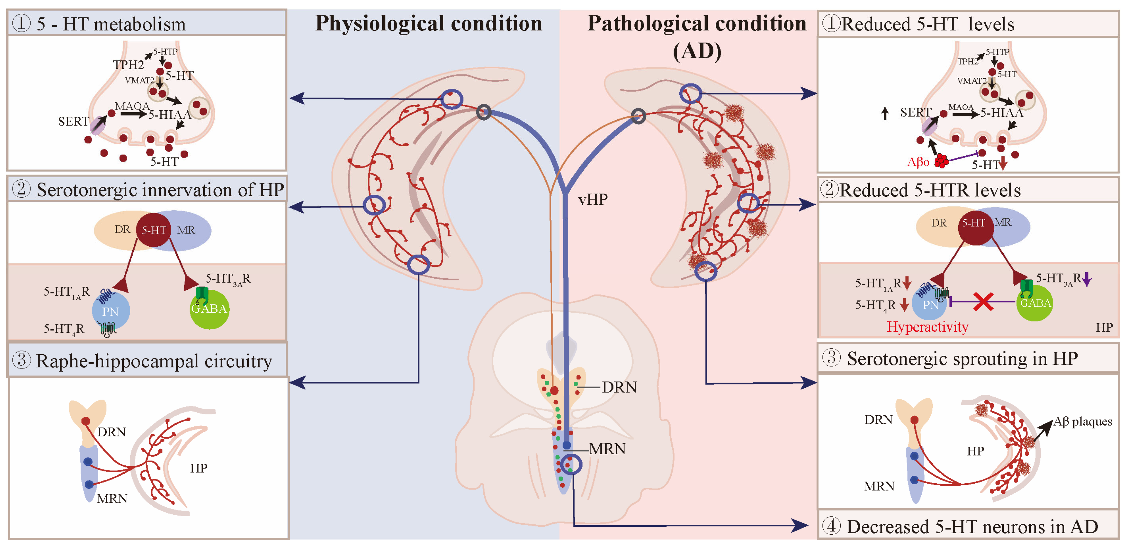 Emerging role of non-coding RNAs in neuroinflammation