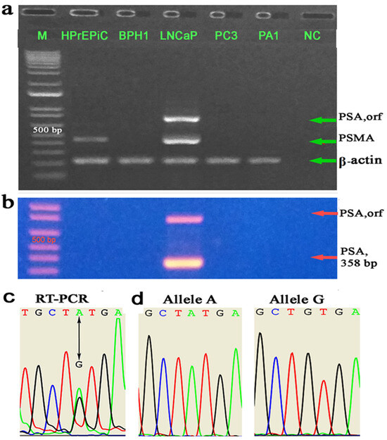 Allele-Specific CG/CCWGG Methylation of the PSA Promoter Discriminates ...