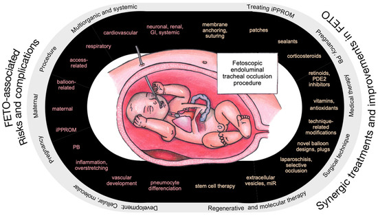 Diagram ilustrujący bezpieczeństwo i funkcje efortuna