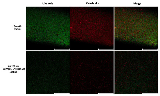 A Weapon Against Implant-Associated Infections: Antibacterial and