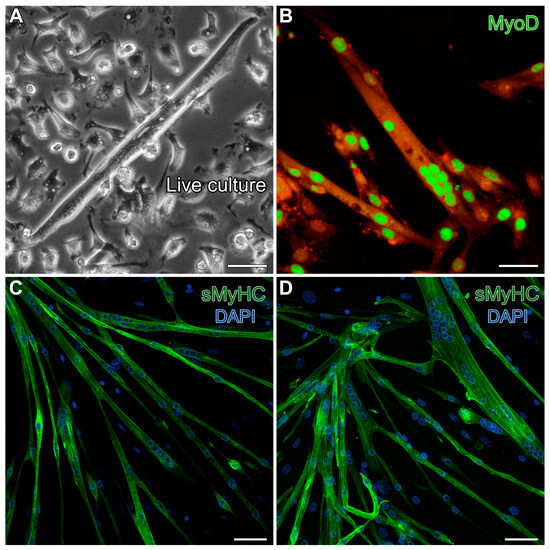 Stem Cells Associated with Adult Skeletal Muscle Can Form