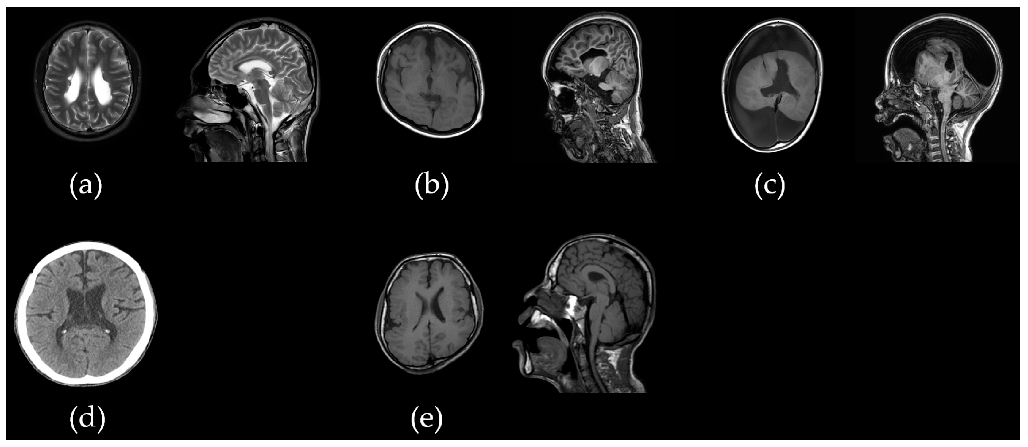 Ijms 26 02929 g002 Ijms 26 02929 g002