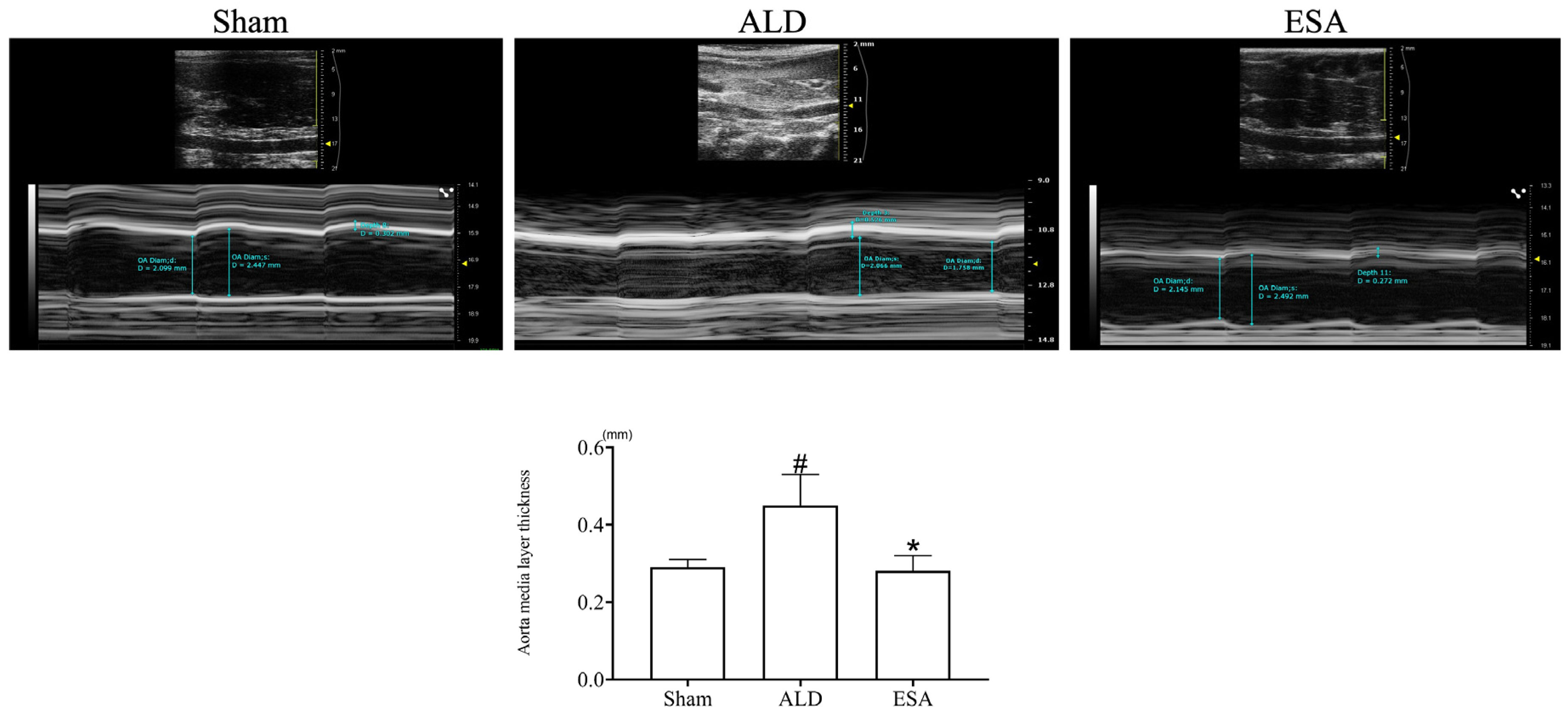 Aldosterone-Induced Transformation of Vascular Smooth Muscle