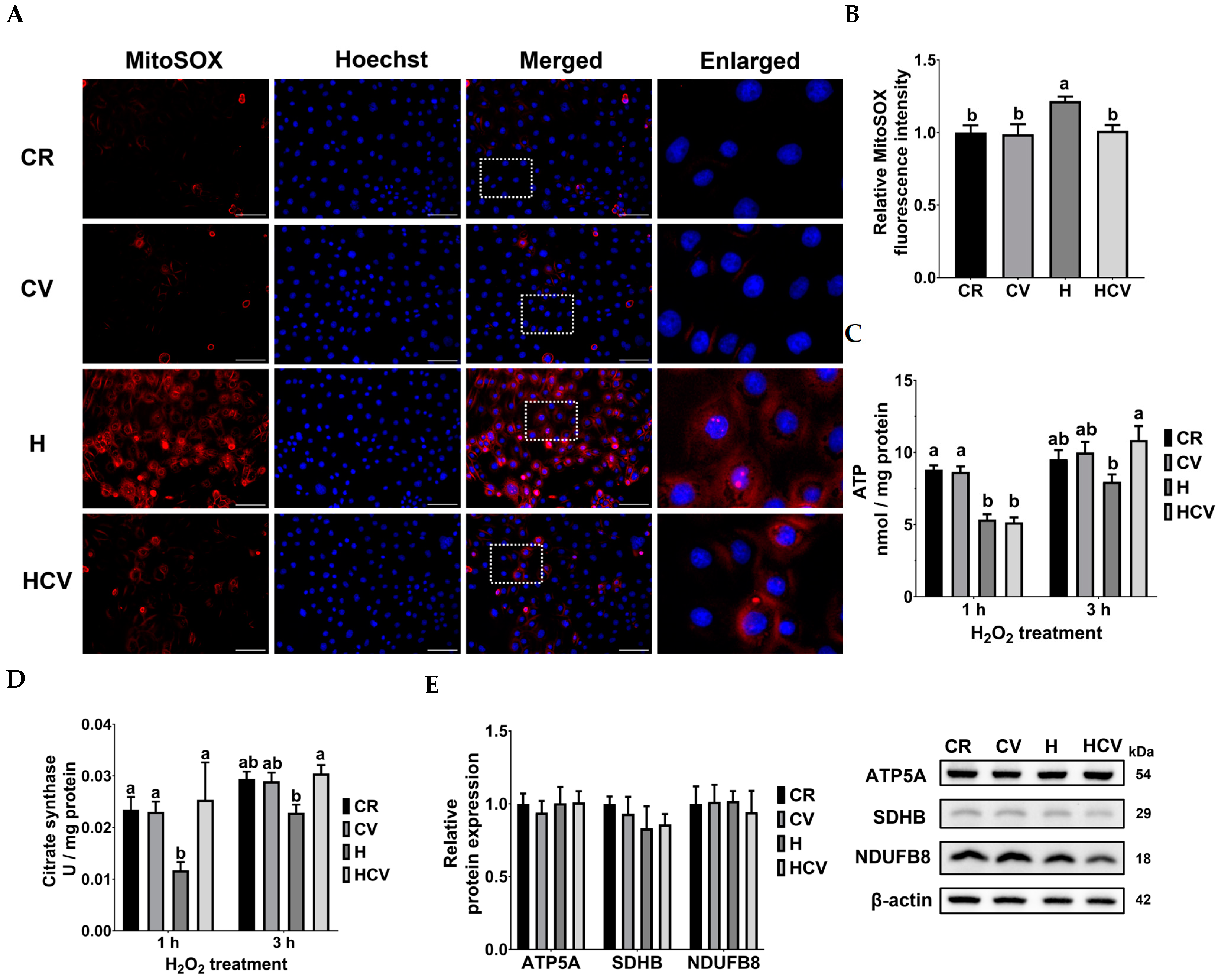 Carvacrol Protects IPEC-J2 Cells from Oxidative Stress by