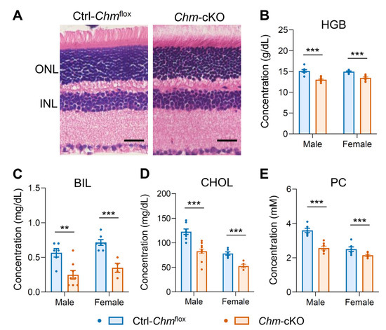 コング Genetic Analysis of Choroideremia-Related Rab Escort Proteins