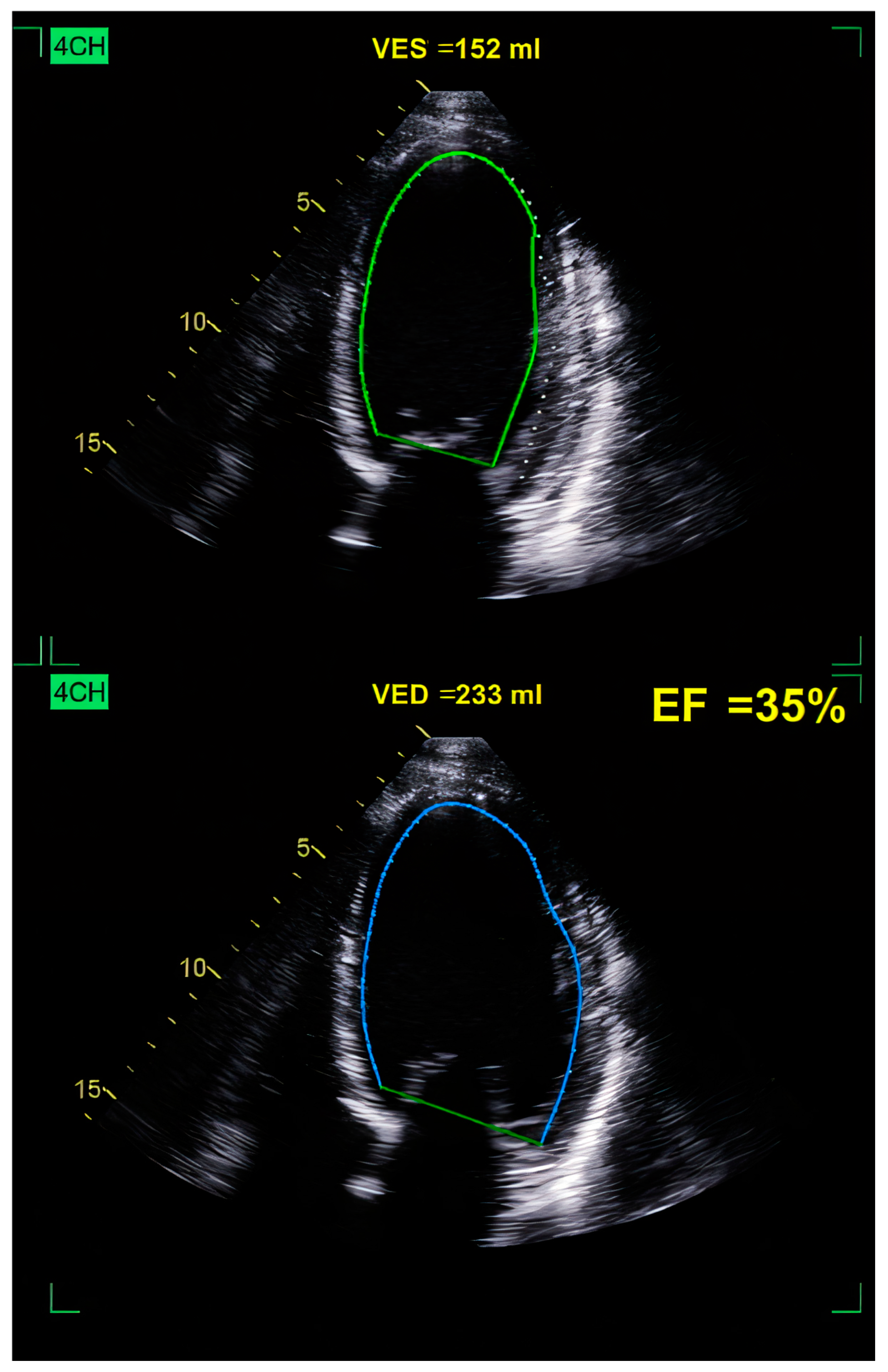 Ijms 26 04181 g003 Ijms 26 04181 g003