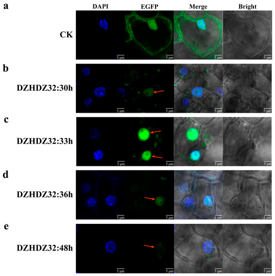 gene✱ai様 Hypoxia-induced loss of SRSF2-dependent DNA methylation