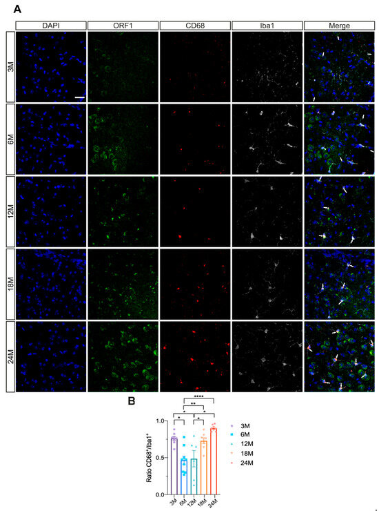 Retrotransposon Protein L1 ORF1p Expression in Aging Central Nervous System