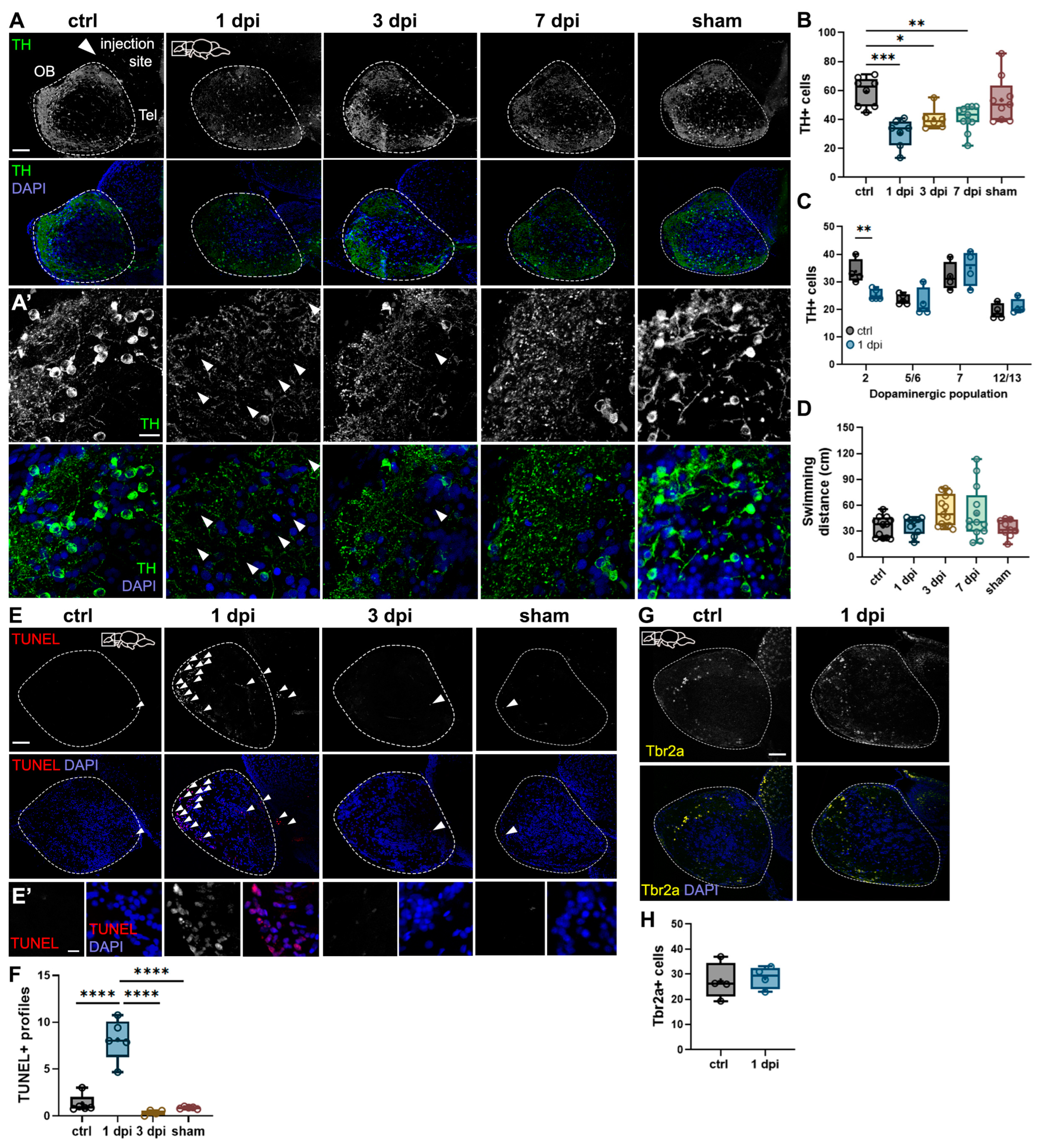 日本最大の Olfactory Dysfunction in a Novel Model of Prodromal アイドルグッズ