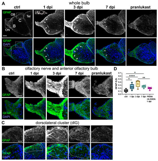 Olfactory Dysfunction in a Novel Model of Prodromal