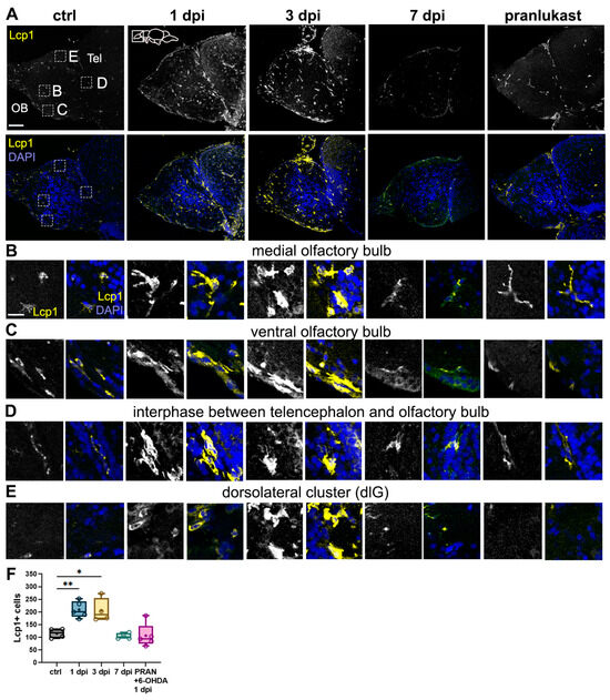 Olfactory Dysfunction in a Novel Model of Prodromal