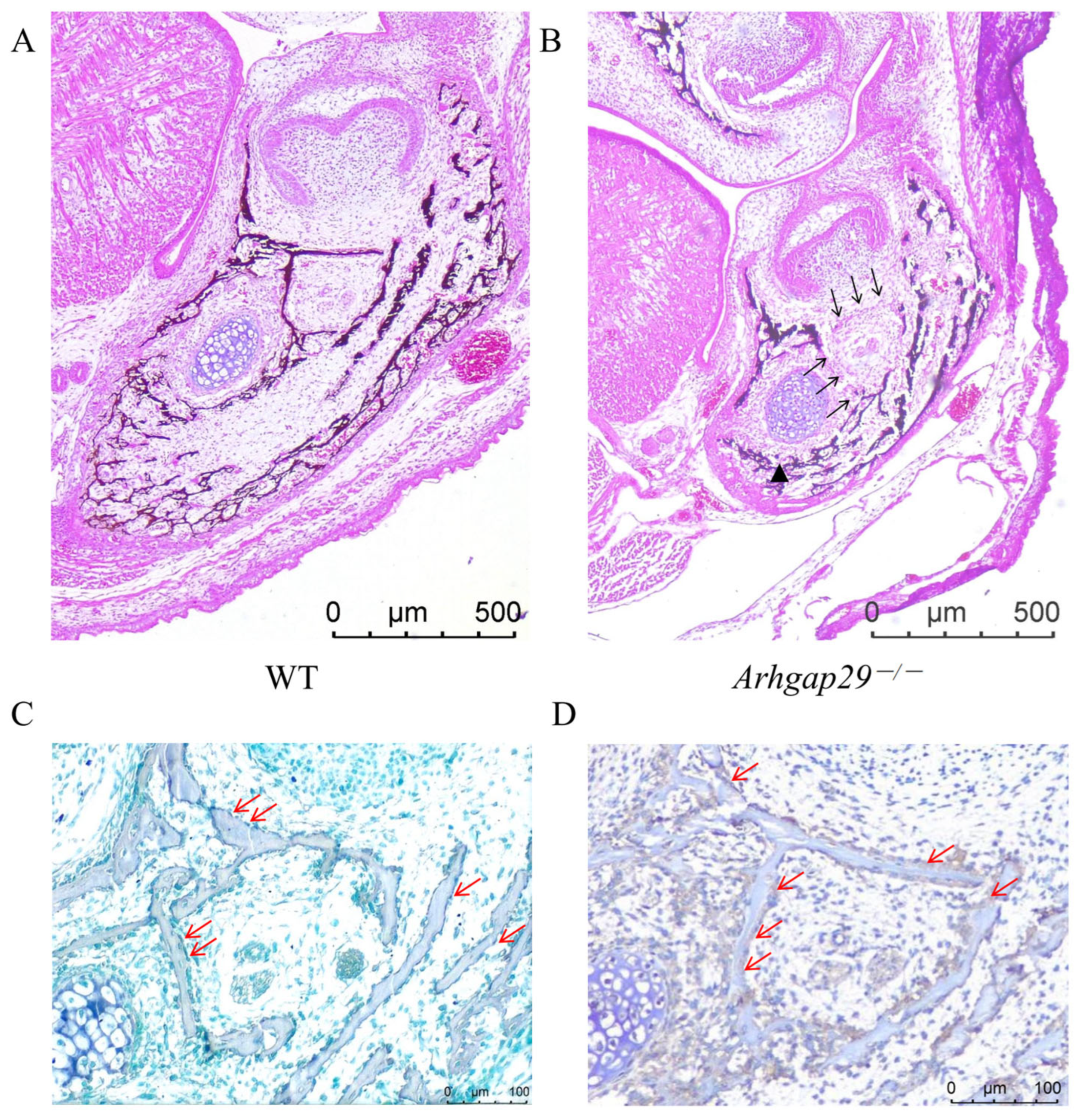 Arhgap29 Deficiency Directly Leads to Systemic and
