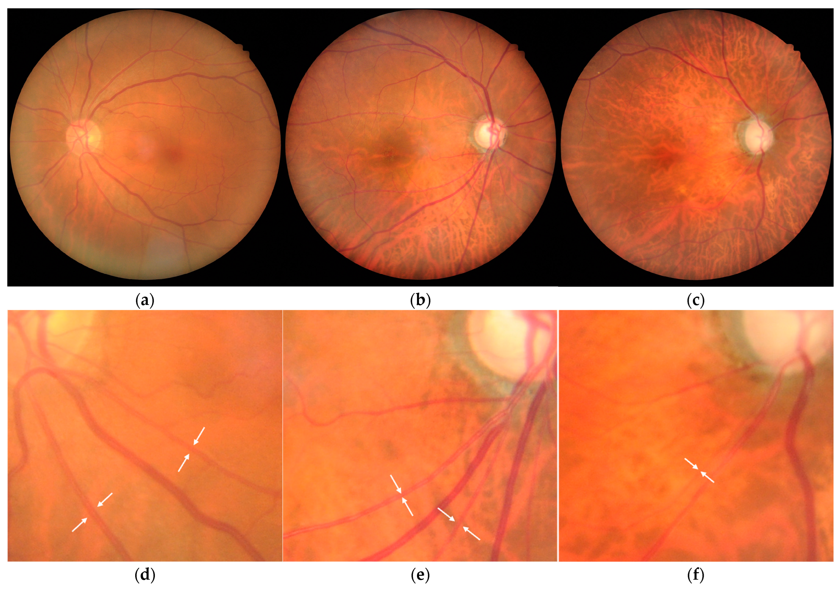 Ijms 26 04725 g004 Ijms 26 04725 g004