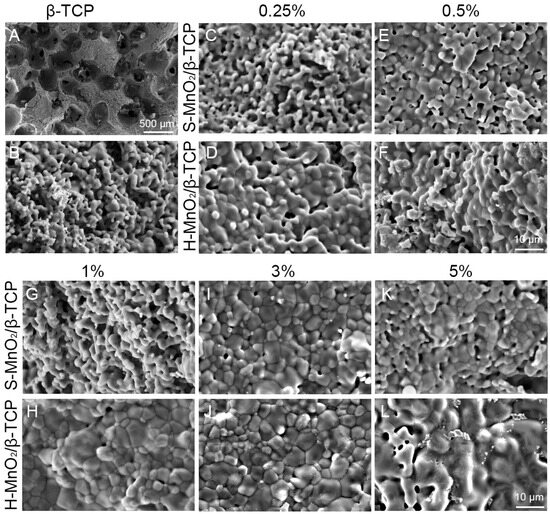 Doping of Hollow Urchin-like MnO2 Nanoparticles in Beta-Tricalcium ...