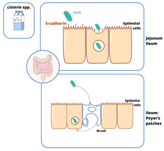 Can Nature Overcome Invasive Gastrointestinal Infections?