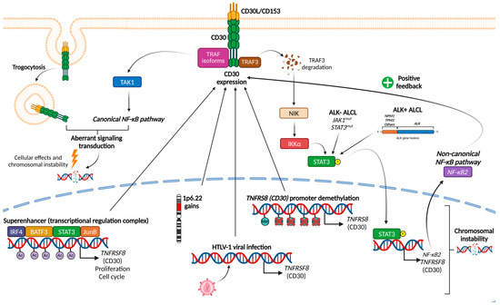 Molecular Insights into the Diagnosis of Anaplastic Large Cell Lymphoma ...