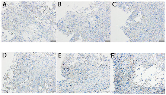 Analysis of the Expression Patterns of Tumor Necrosis Factor Alpha ...