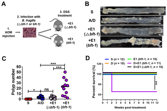 ゴンザレス Modeling ETBF-Mediated Colorectal Tumorigenesis Using AOM