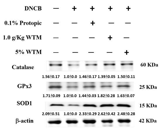 ステートメント The pretreatment lymphocyte to monocyte ratio predicts