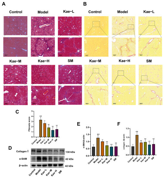 Kaempferol Alleviates Carbon Tetrachloride-Induced Liver