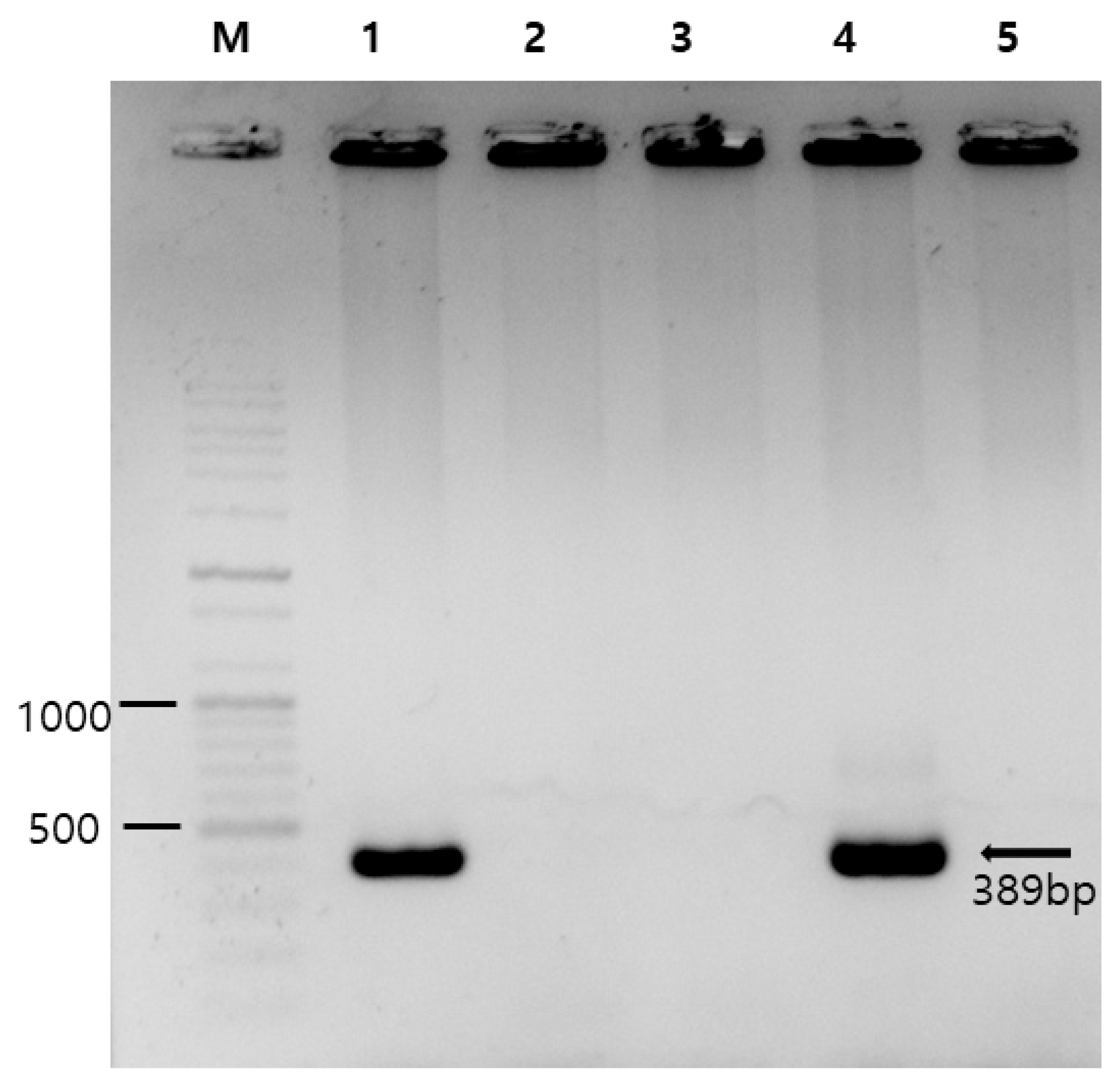 Molecular Detection and Genotyping of Enterocytozoon