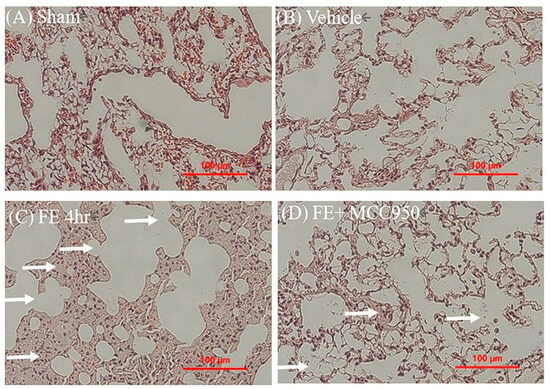 MCC950 Alleviates Fat Embolism-Induced Acute Respiratory