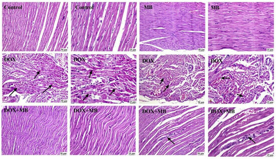 Methylene Blue Mitigates Doxorubicin-Induced Cardiotoxicity via  KEAP1/NRF2/GPX-4/Caspase3 Modulation