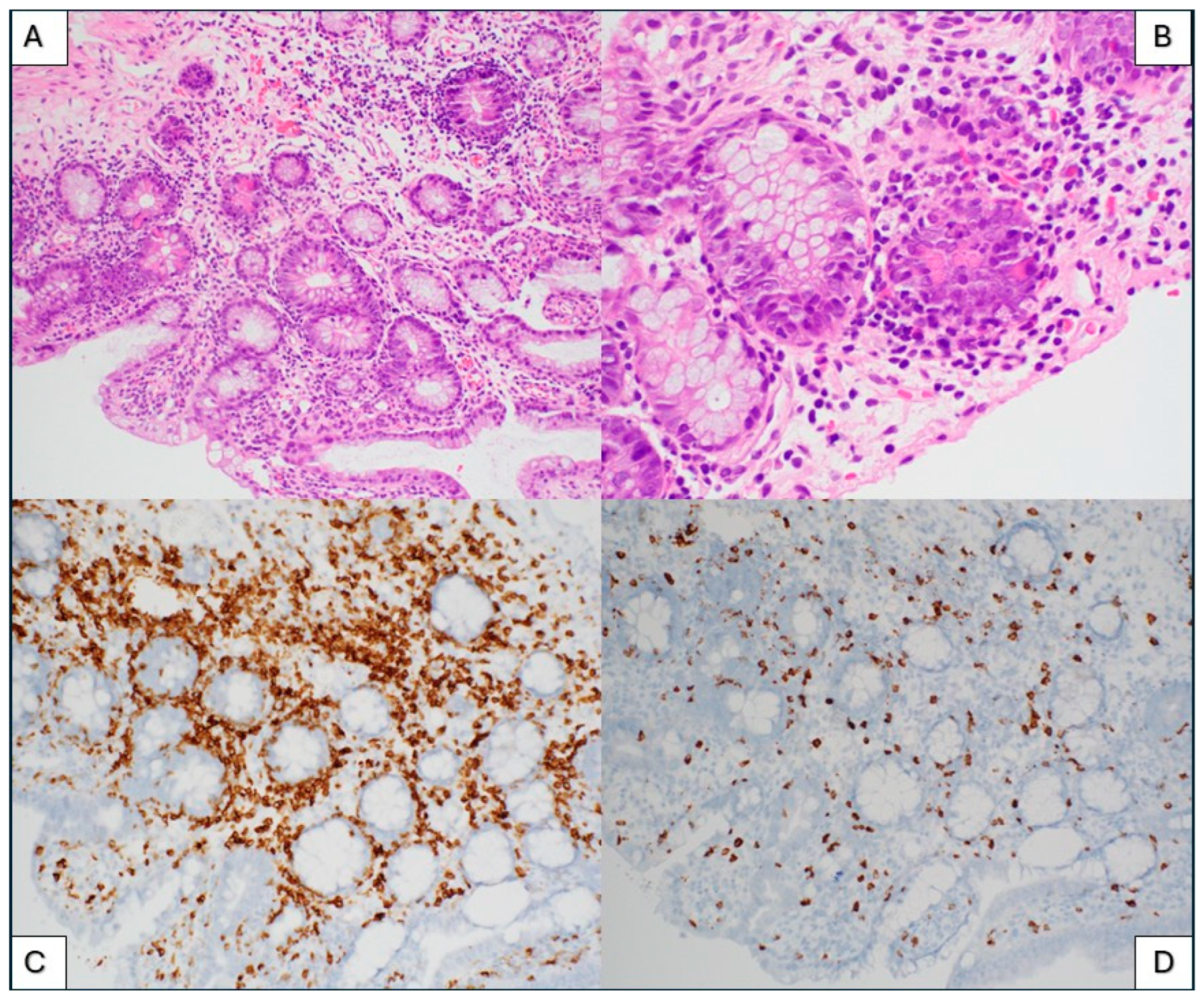 Ijms 26 08388 g004 Ijms 26 08388 g004