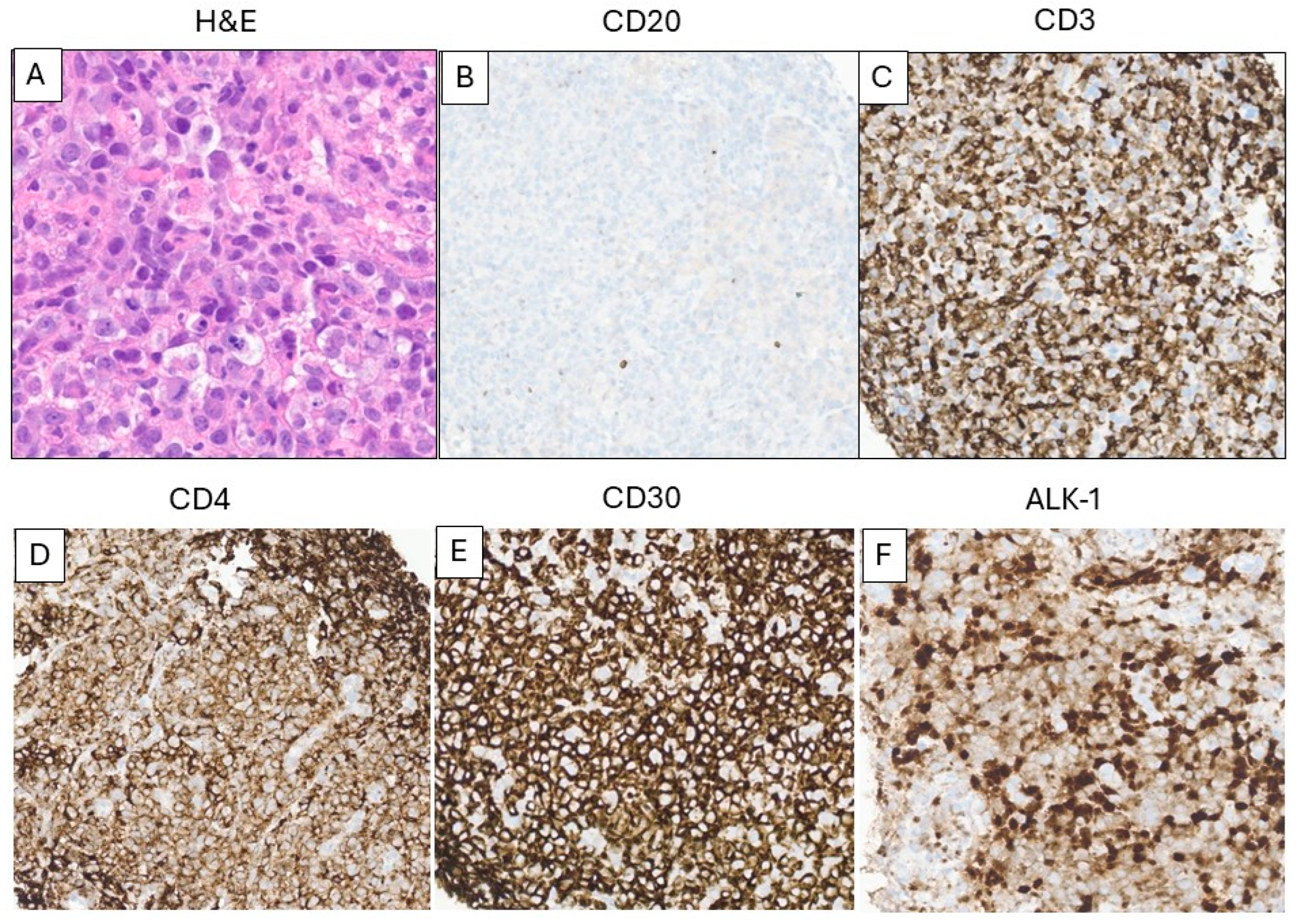 Ijms 26 08388 g005 Ijms 26 08388 g005