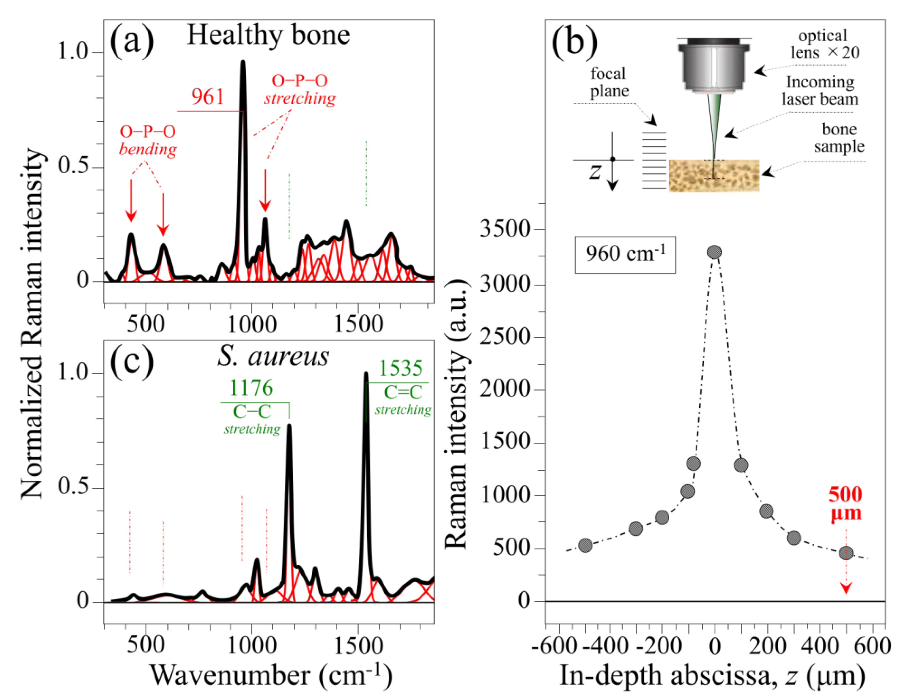 Ijms 26 08572 g003 Ijms 26 08572 g003