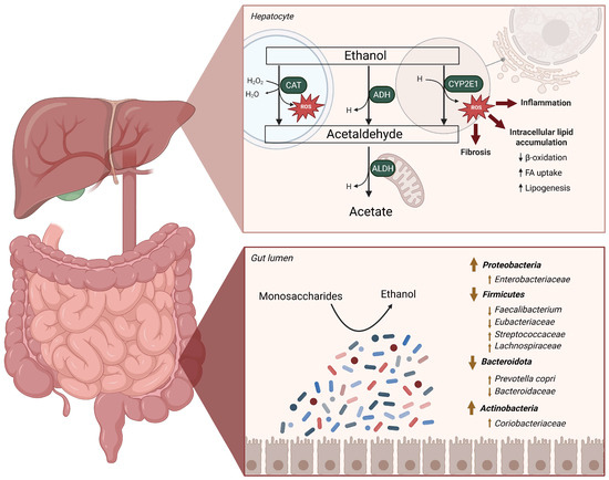 Endogenous Ethanol Metabolism and Development of MASLD-MASH