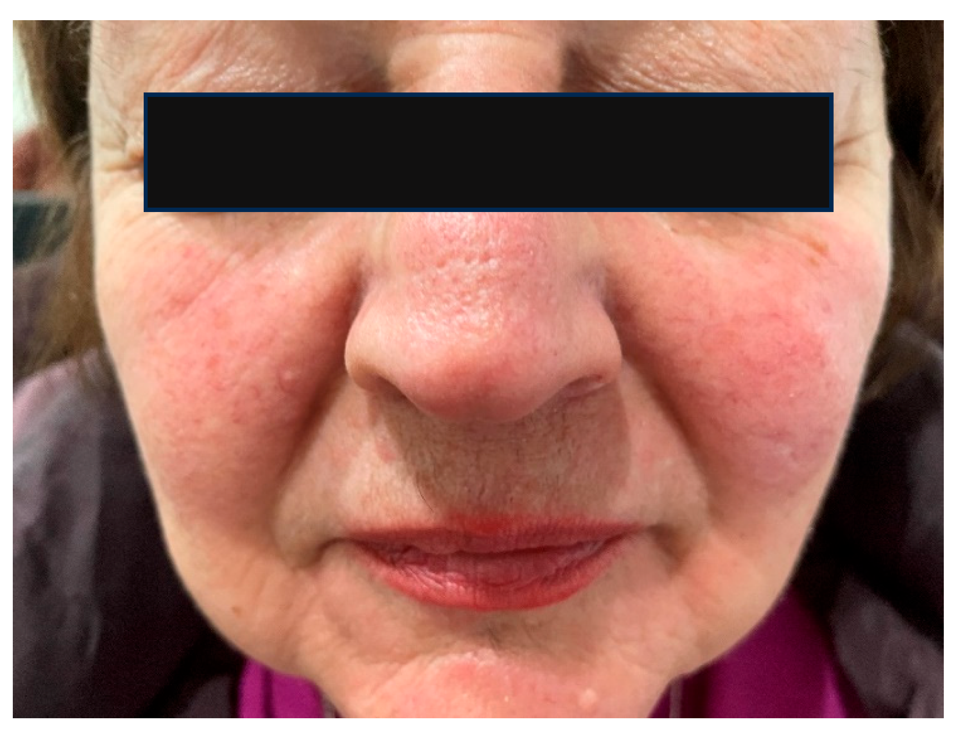 Ijms 26 08857 g004 Ijms 26 08857 g004