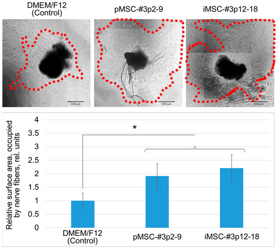 Safety and Regenerative Properties of Immortalized Human