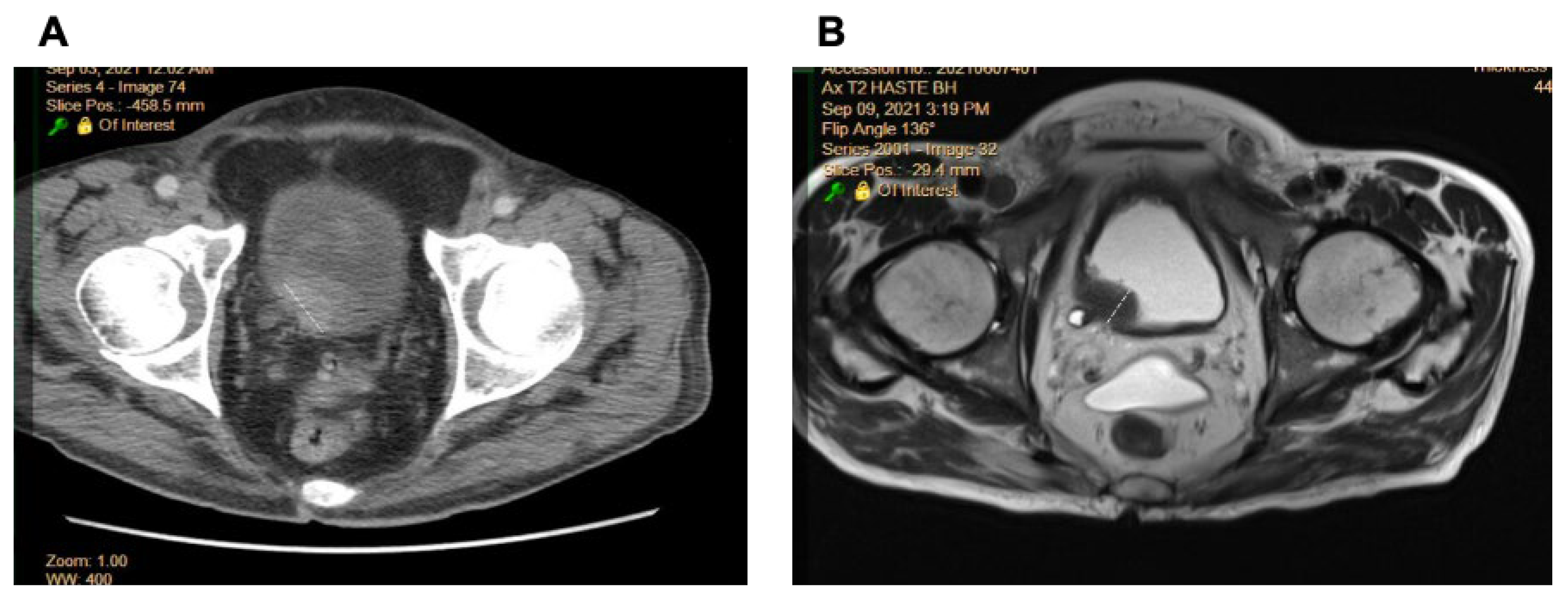 Ijms 26 09570 g001 Ijms 26 09570 g001